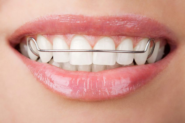What kind of dental support do you get from orthodontic treatment