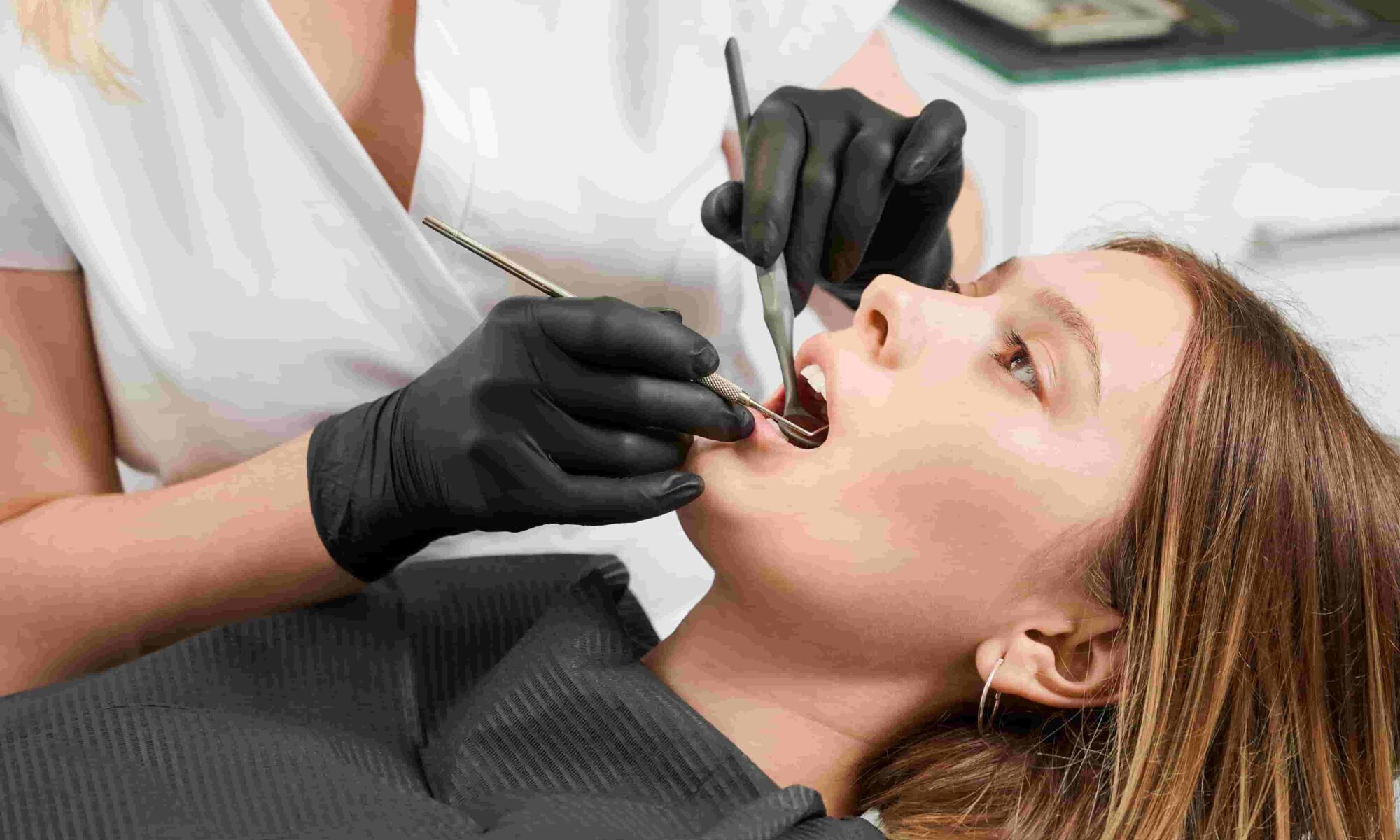 wisdom teeth removal