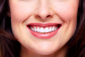 Does Teeth Whitening Damage Your Teeth?