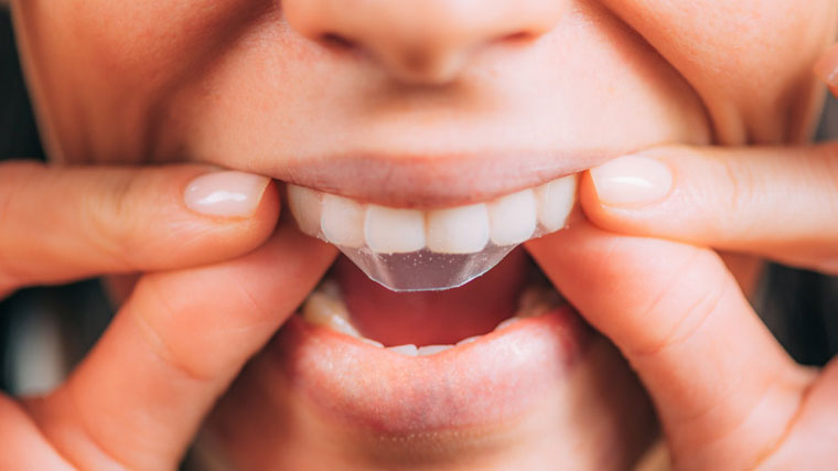 Teeth whitening strips