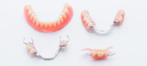 Partial Dentures