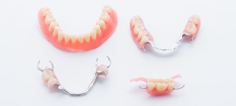 Partial Dentures