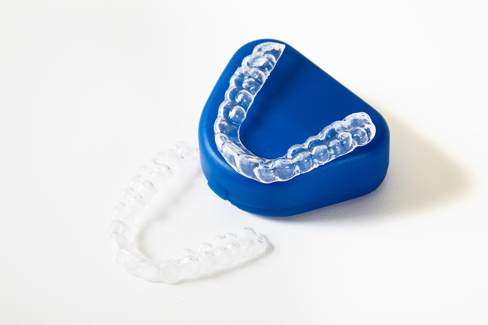 mouth guards at Bespoke Dental